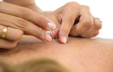 We now offer Acupuncture at our Bawtry Clinic too